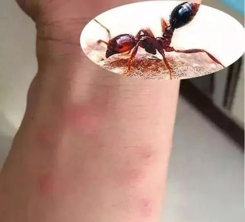 梦见被蚂蚁咬