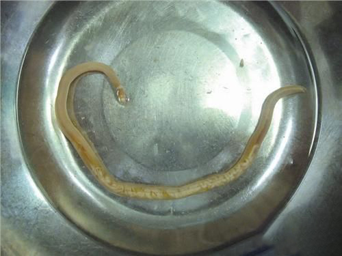 梦见从腿上拔出寄生虫