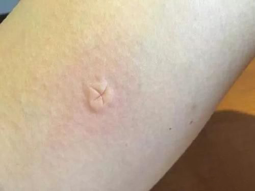 梦见被鬼咬手