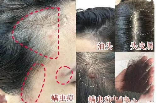 梦见鬼剥人的头皮