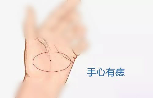 手背痣主才巧，掌上痣主荣华富贵，您有好痣相吗？
