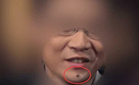 面相专业知识~论男人痣相颜色凶吉
