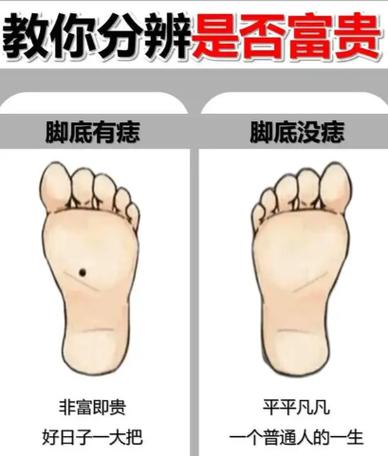 脚底有痣是福是祸？揭秘脚底痣相与生肖运势的奥秘