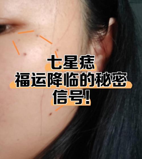 红痣相好坏 看位置和生肖就知道吉凶