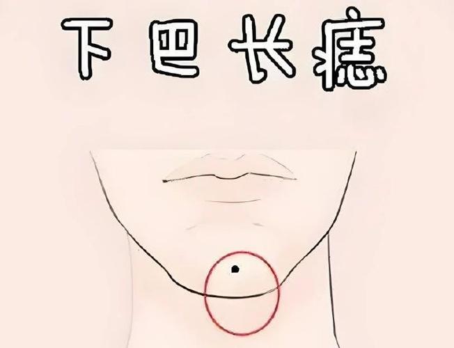 面相学 痣位 事业运势_痣相和事业