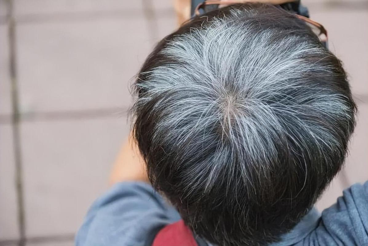 已婚女人梦见头发秃了一块：可能暗示情感压力或婚姻隐患