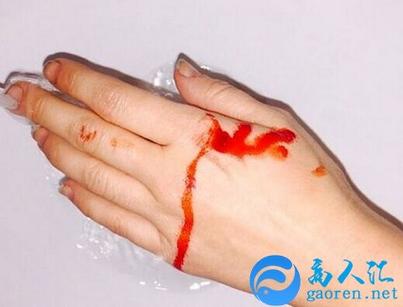 梦见手流血是什么征兆 解梦分析