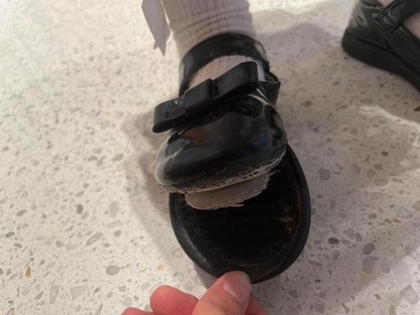 梦见自己两只鞋都丢了